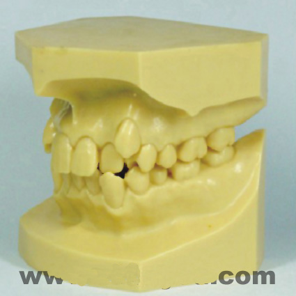 �e(cu��)�M���η����ʾģ��A