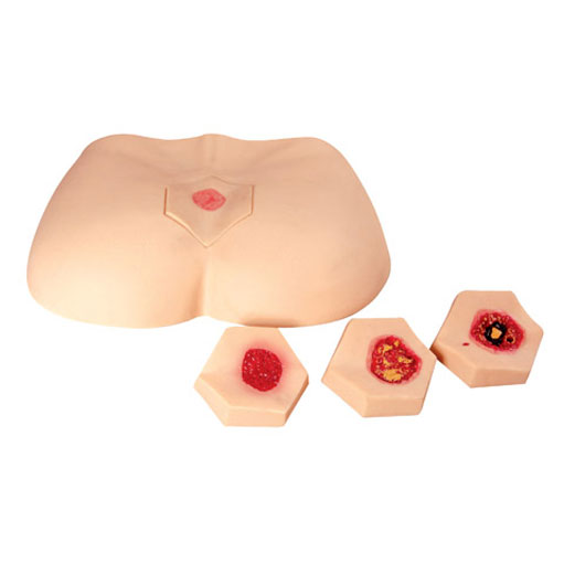 �A���쯏�o(h��)��ģ��