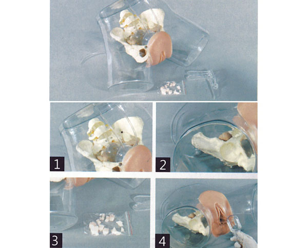 �߼�(j��)͸���Όmģ��