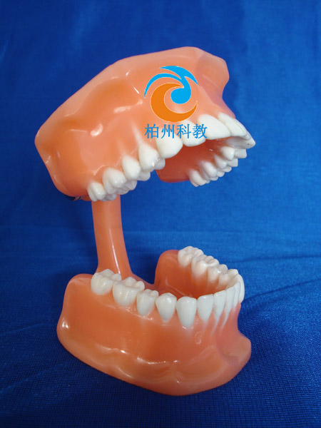 �pɫ����ģ�ͣ���frassaco�M�ܣ�