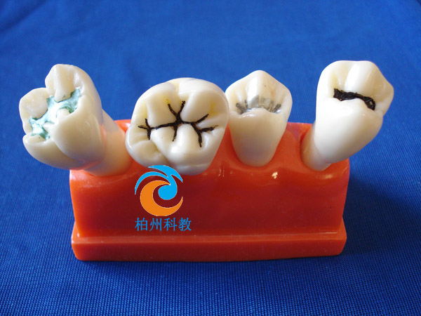 2���C�Ϸ��]ģ��