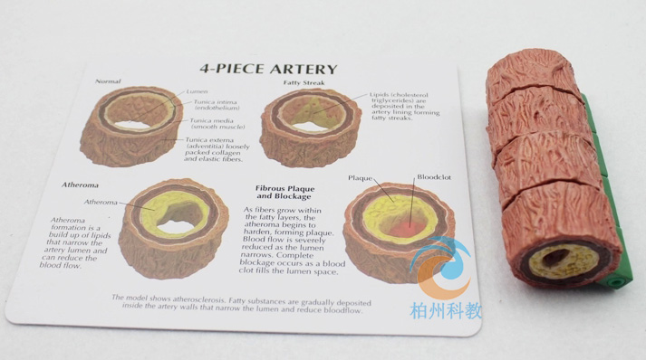 ���}Ӳ����Ѫ˨ģ�ͣ����ͣ�