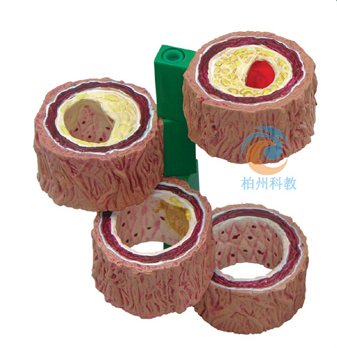 �ڠ��(d��ng)�}����Ѫ�܄�(d��ng)�}Ӳ��ģ��