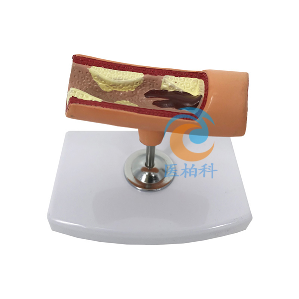 Ѫ��Ѫ˨ģ��